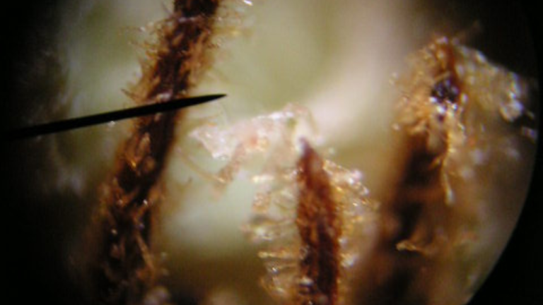 The THC crystals on a cannabis plant bud